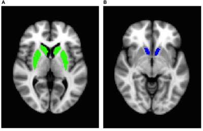 Influences of Dietary Added Sugar Consumption on Striatal Food-Cue Reactivity and Postprandial GLP-1 Response